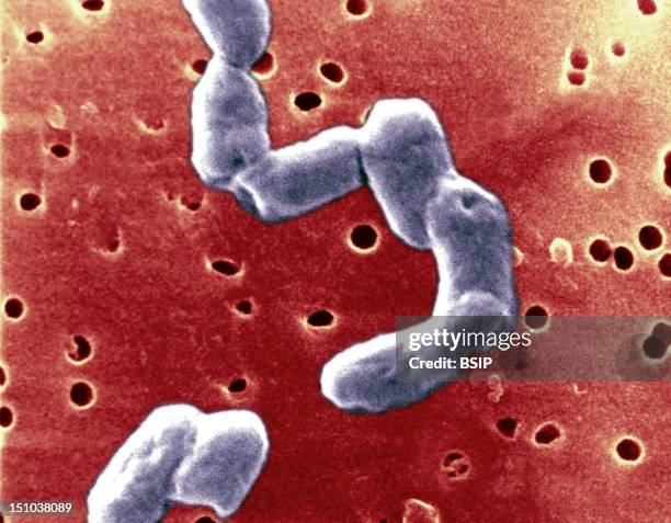 Motile Rods Rod Shaped Bacteria Microscope Photos and Premium High Res Pictures ...