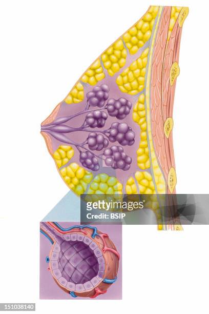 The Breast Is A Gland Which Lies Over The Pectoral Muscles Pink Structures On The Right. The Glandular Tissue Is Composed Of Lobules Purple Clusters...