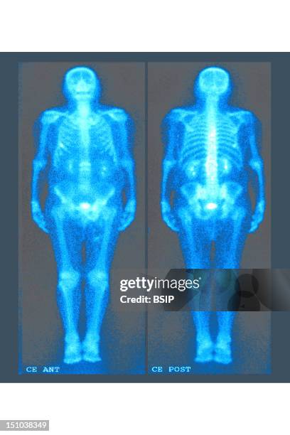Internal Fat Scan 229 Body Fat Scan Stock Photos, High-Res Pictures, and Images - Getty ...