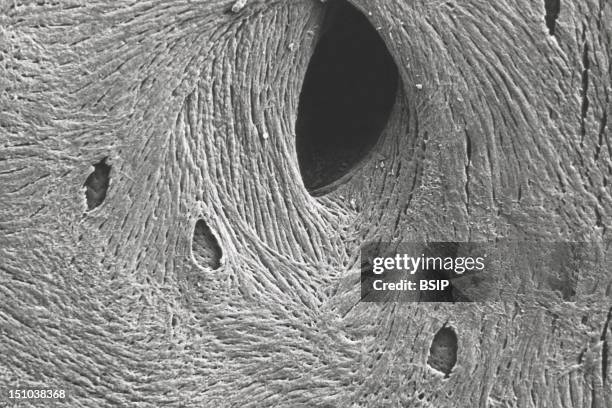 Surface Of Bone. Vascular Canal. Osteoblasts Viewed Under Sem. Magnification: 600X.