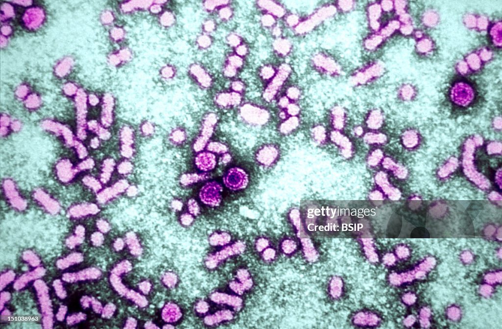 Hepatitis B Virus