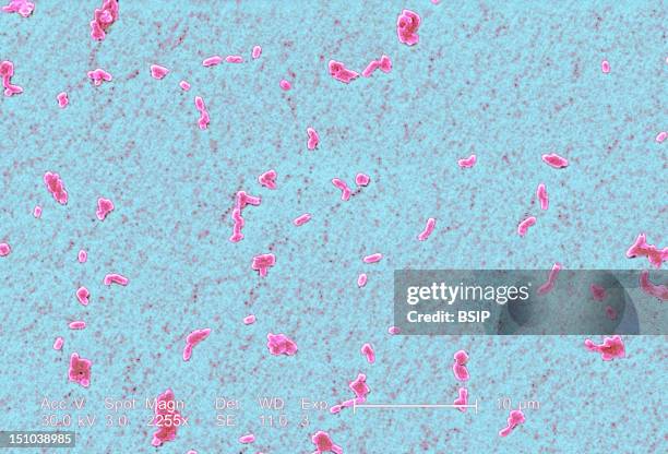 Motile Rods 112 Rod Shaped Bacteria Microscope Stock Photos, High-Res Pictures, and ...