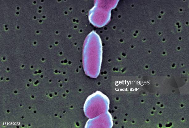 This Scanning Electron Micrograph Sem Depicts A Number Of Vibrio Parahaemolyticus Bacteria; Mag. 19058X. Vibrio Parahaemolyticus Is A Bacterium In...