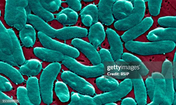 This Scanning Electron Micrograph Sem Depicts A Grouping Of Vibrio Vulnificus Bacteria; Mag. 13184X. Vibrio Vulnificus Is A Bacterium In The Same...