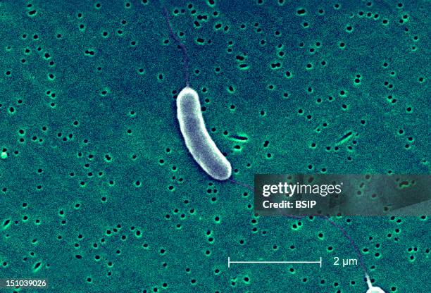 This Scanning Electron Micrograph Sem Depicts A Flagellated Vibrio Vulnificus Bacterium; Mag. 13184X. Vibrio Vulnificus Is A Bacterium In The Same...