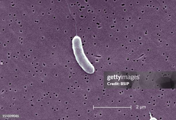 This Scanning Electron Micrograph Sem Depicts A Flagellated Vibrio Vulnificus Bacterium; Mag. 13184X. Vibrio Vulnificus Is A Bacterium In The Same...