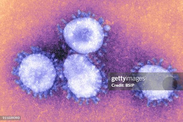 The Coronaviruses Owe Their Name To The The Crown Like Projections, Visible Under Microscope, That Encircle The Capsid. The Coronaviruses Are...