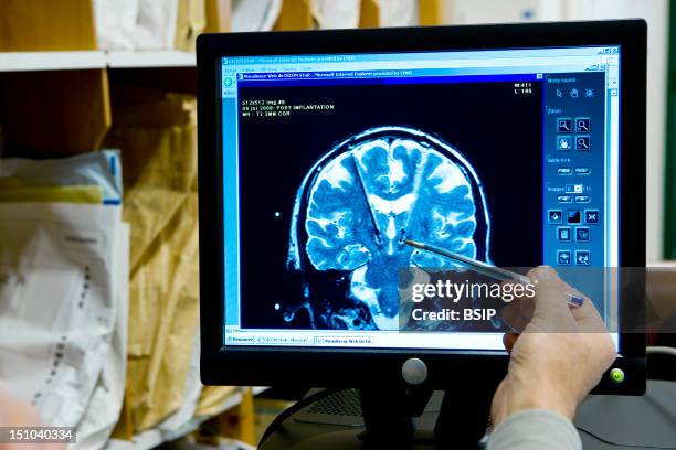 Photo Essay From Hospital. Grenoble University Hospital Michallon Hospital Department Of Neurology Unit 'Movement Disorder'. Mri Of A 30 Year Old...