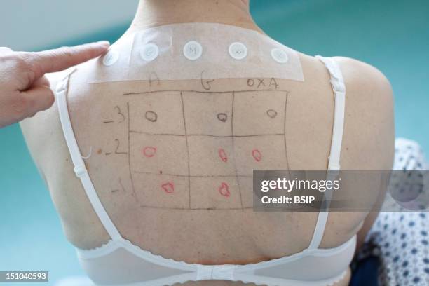 Allergy Test, Woman