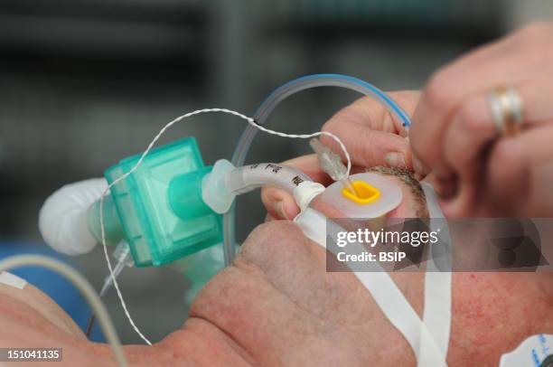 Photo Essay At Lyon Hospital In France. Department Of Urology. Prostatectomy. This Hospital Has A Robotic Surgical System Da Vinci Surgical System...