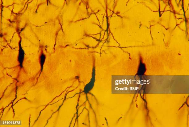Pyramidal Cells Microscope 74 Brain Neuron Microscope Stock Photos, High-Res Pictures, and Images ...