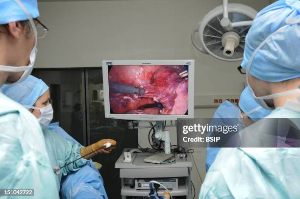 Photo Essay At Lyon Hospital, France. Department Of Urology. Sex Reassignment Sugery Transgender Ftm. Here Hystero Ovariectomy Under Laparoscopy....