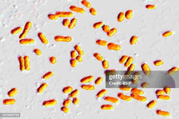 Gram Positive Bacilli Responsible For Urinary Tract Infections, Blood Poisoning, And Diarrhea. Optical Microscope X 600.