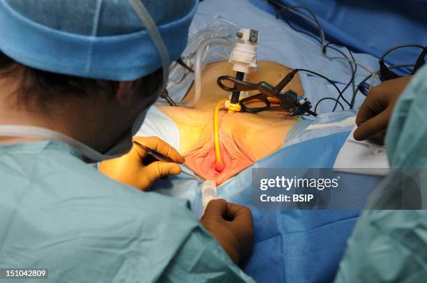 Photo Essay At Lyon Hospital, France. Department Of Urology. Sex Reassignment Sugery Transgender Ftm. Here Hystero Ovariectomy Under Laparoscopy....