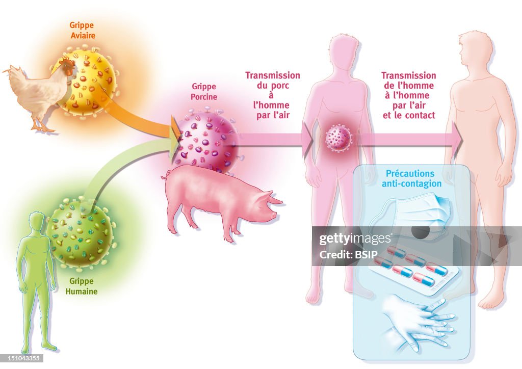 Influenza A H1N1 Infection