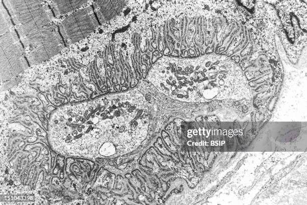 Motor End Plates. Motor End Plates Are The Neuromuscular Junctions That Conduct The Nerve Impulse Action Potential From The Axon To The Muscle Fiber.