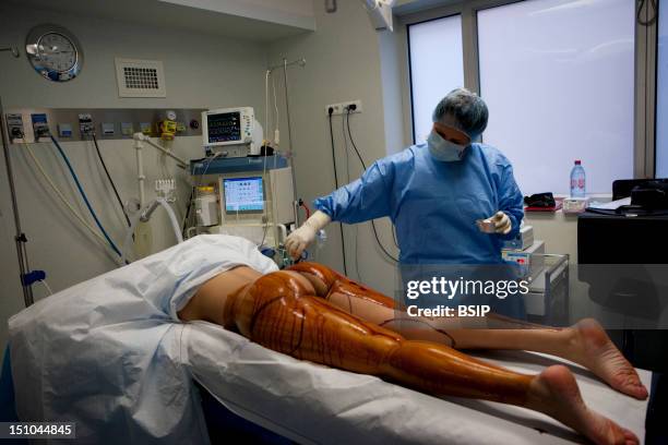 Photo Essay In Cosmetic Surgery. Liposuction. The Nurse Is Daubbing The Patient With Betadine Before The Intervention.