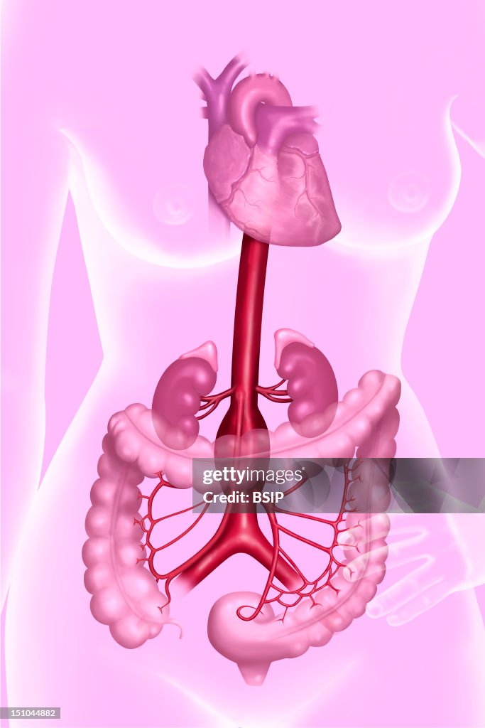 Aneurysm Of The Abdominal Aorta