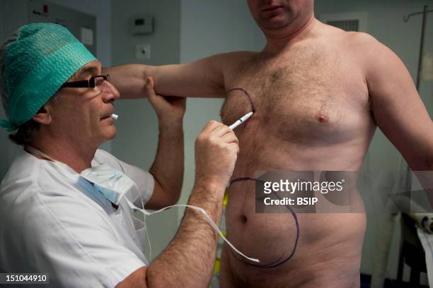 Photo Essay In Aesthetic Surgery. Liposuction.