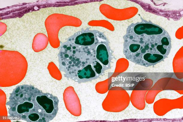 Capillary Blood With Red Corpuscles And 3 Polymorphonuclear Cells Leukocytes. The Red Blood Corpuscles In Red Vary In Shape For Two Reasons 1 Their...