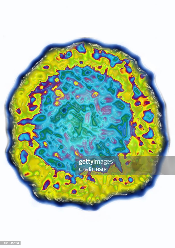 Hepatitis B Virus