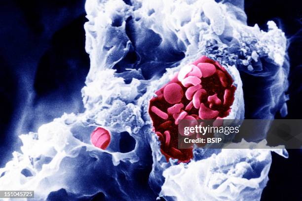 Red Blood Cells In Arteriole, In Lungs. Sem