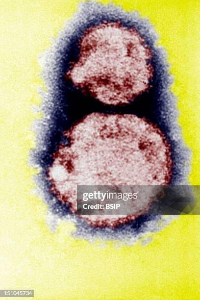 Hantavirus, The Causal Agent Of Hantavirus Pulmonary Syndrome Hps. This Electron Micrograph Depicts The Hantavirus Virions Responsible For Causing...