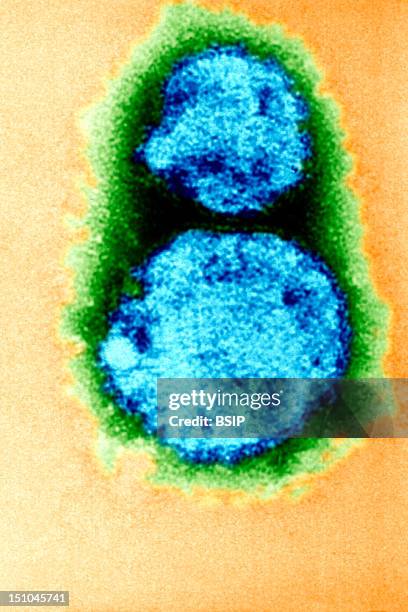 Hantavirus, The Causal Agent Of Hantavirus Pulmonary Syndrome Hps. This Electron Micrograph Depicts The Hantavirus Virions Responsible For Causing...