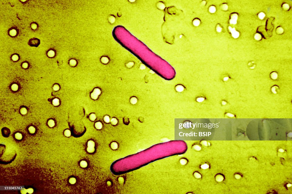 Salmonella Typhimurium