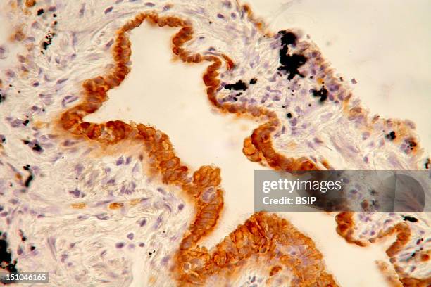 Histological Section Of A Human Adult Bronchi. Staining With Dapi For Nuclear Dna, In Blue. Magnification: 150X.