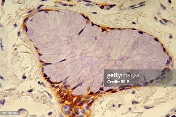 Histological Section Of A Normal Human Adult Bronchi. Staining With An Anti Cytokeratin 19 Antibody, In Brown, And With Hematoxylin For Nuclear Dna,...