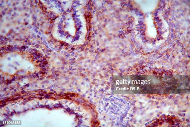 Histological Section Of A Human Fetal Lung At The Stage Of 12 Weeks Of Gestation. Staining With An Anti Cd44 Antibody, In Brown, And With Hematoxylin...