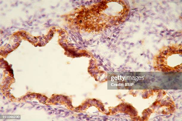 Histological Section Of A Human Fetal Lung At The Stage Of 14 Weeks Of Gestation. Staining With An Anti Cytokeratin 7 Antibody, In Brown, And With...