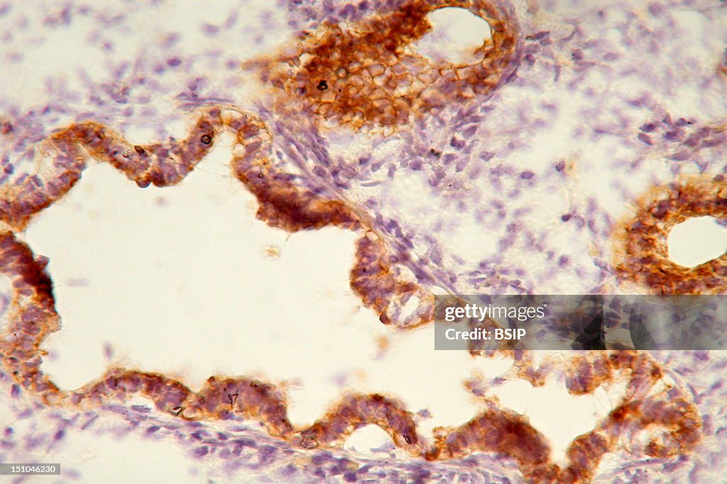 Lung Ftal Histology