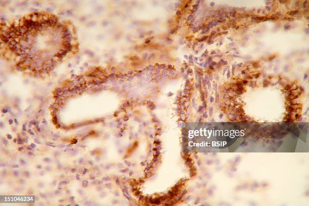 Histological Section Of A Human Fetal Lung At The Stage Of 14 Weeks Of Gestation. Staining With An Anti Cd44 Antibody, In Brown, And With Hematoxylin...