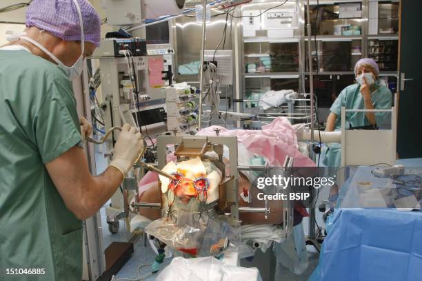 41 Craniotomy Stock Photos High Res Pictures And Images Getty Images 41-craniotomy-stock-photos-high-res-pictures-and-images-getty-images