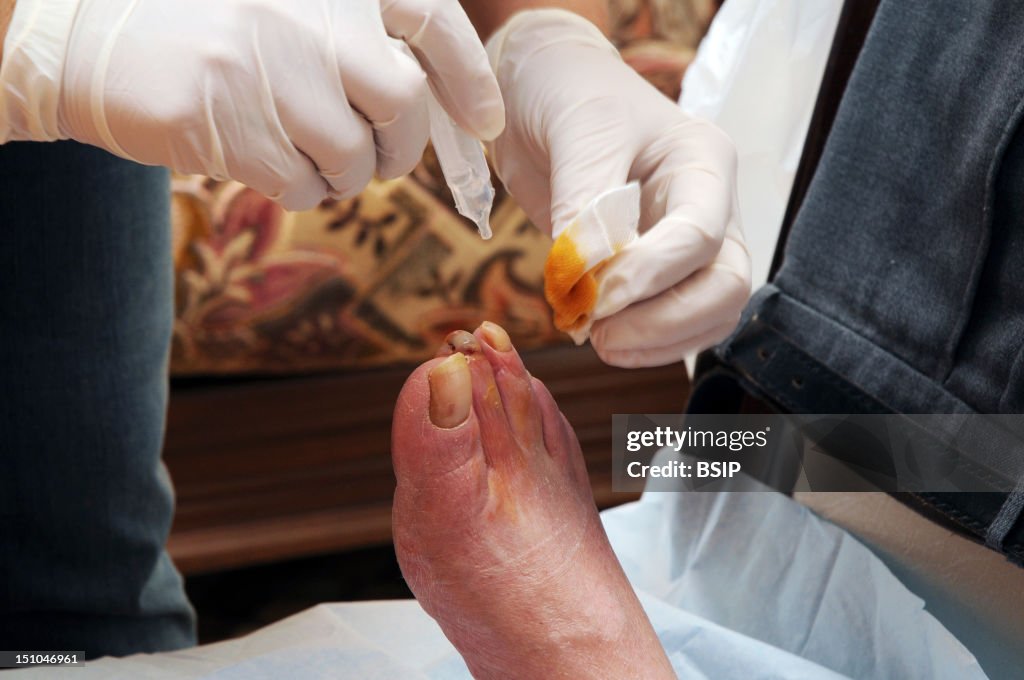 Diabetic Foot Care