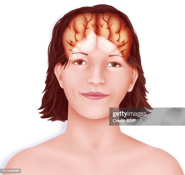 Brain Right And Left Cerebral Hemispheres Separated By The Longitudinal Fissure Set Up In A Woman's Face.