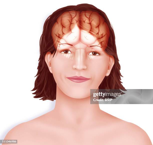 Brain Right And Left Cerebral Hemispheres Separated By The Longitudinal Fissure, The Cerebellum And The Brain Stem Set Up In A Woman's Face.