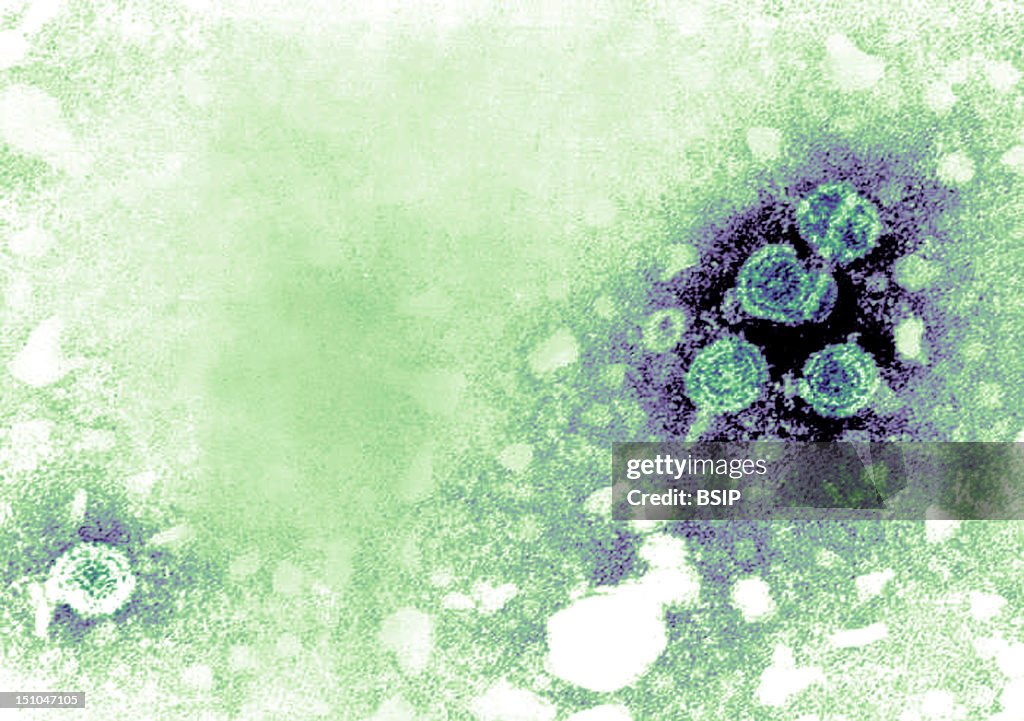 Hepatitis B Virus