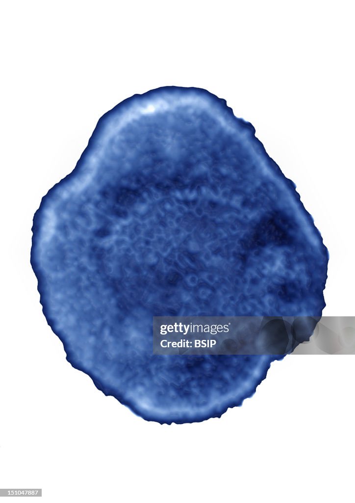 Mononucleosis Virus