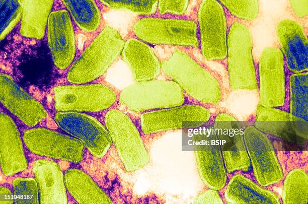 Causal Agent Of Vesicular Stomatitis In Cattle, Horses And Pigs. This Electron Micrograph Depicts The Vesiculovirus Responsible For Vesicular...