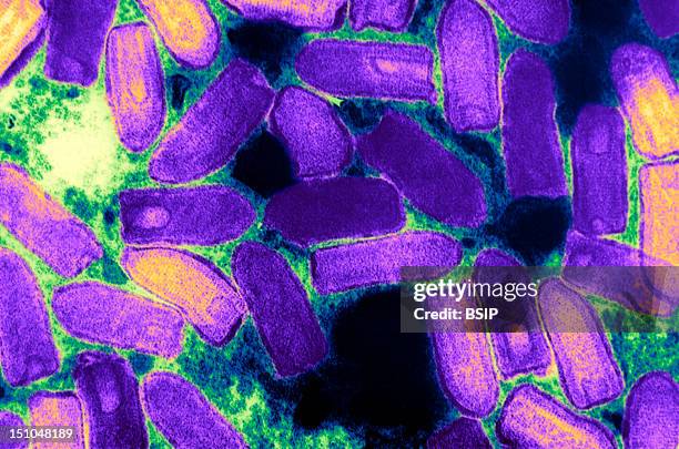 Causal Agent Of Vesicular Stomatitis In Cattle, Horses And Pigs. This Electron Micrograph Depicts The Vesiculovirus Responsible For Vesicular...