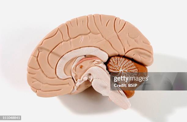 Anatomical Model Of The Human Brain Or Encephalon Cross Section. The Encephalon Is Composed Of The Diencephalon, Covered By The Cerebrum Flesh...