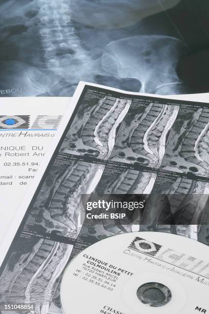Dorsal column hi-res stock photography and images - Alamy