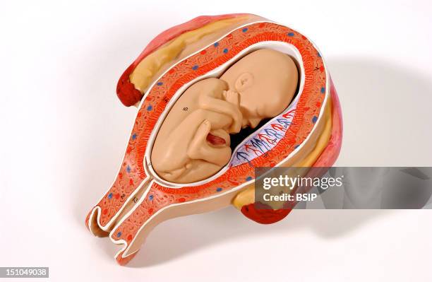 Anatomical Models Of The Female Reproductive Organs During Pregnancy Fetus At Five Months, In Breech Presentation. At Five Months Of Pregnanacy, The...