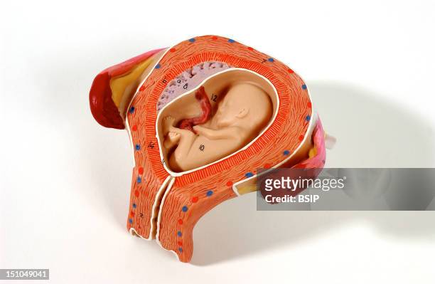 Anatomical Model Of The Female Reproductive Organs During Pregnancy Fetus At Three Months. At Three Months Of Pregnancy, The Womb Has Reached The...