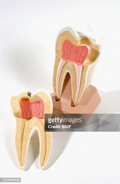 Anatomic Model Of An Human Upper Molar Anterior View Of Frontal Section. The Upper Molar, Located In The Back Of The Jaw, Chews And Grinds Food; It...