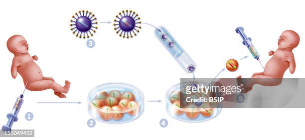 Gene Therapy. Illustration Of A Gene Therapy Technique Which Uses The Introduction Of A Retrovirus Culture Containing A Therapeutic Gene In Order To...