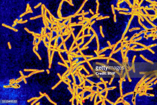 Legionella Pneumophila, The Bacteria Responsible For Legionellosis Or Legionaire's Disease. Symptoms Include Pneumonia, Flu Like Symptoms,...